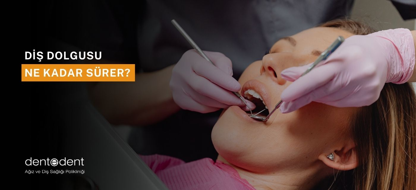 Diş Dolgusu Ne Kadar Sürer