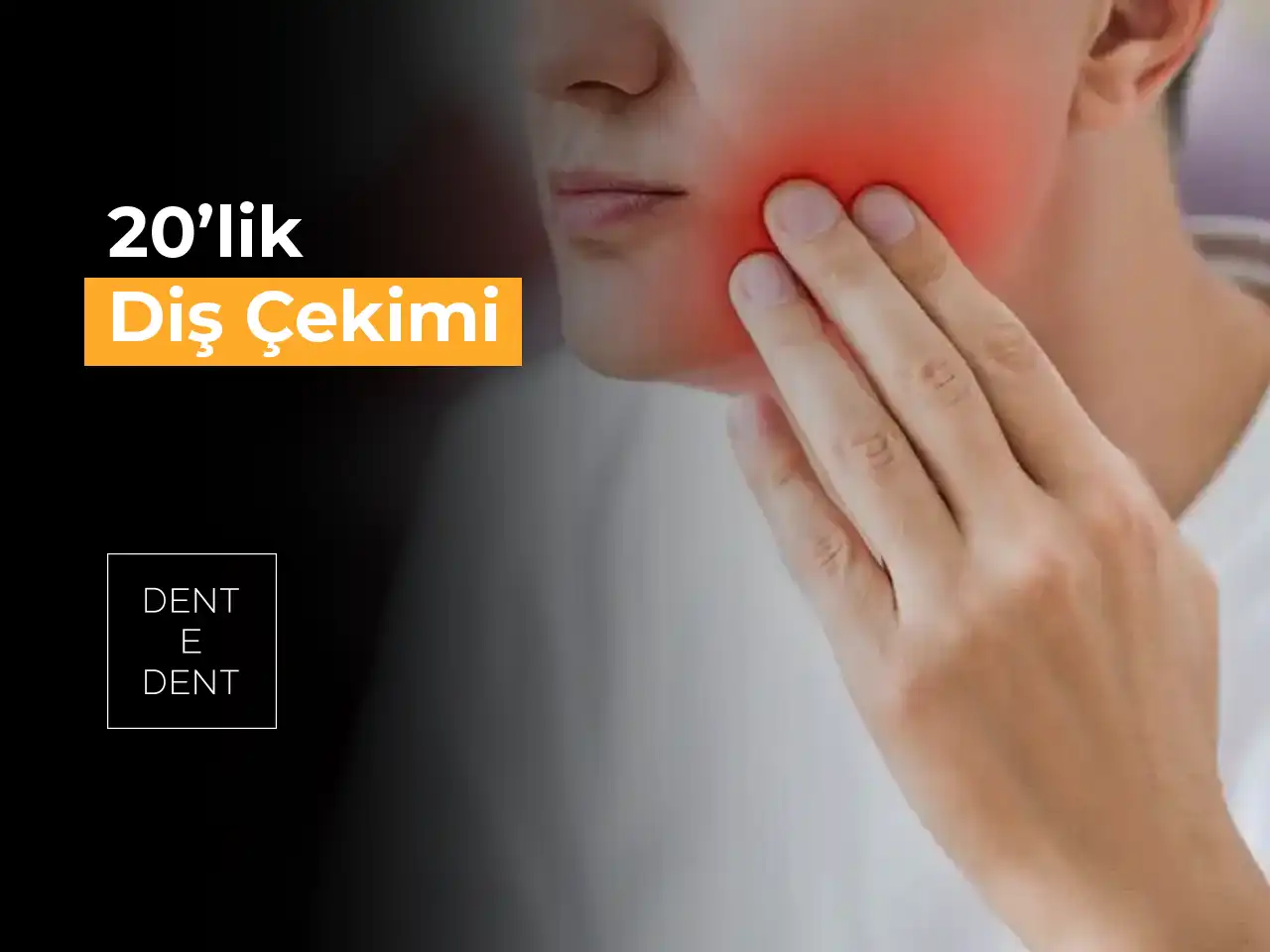 20’lik Diş Çekimi