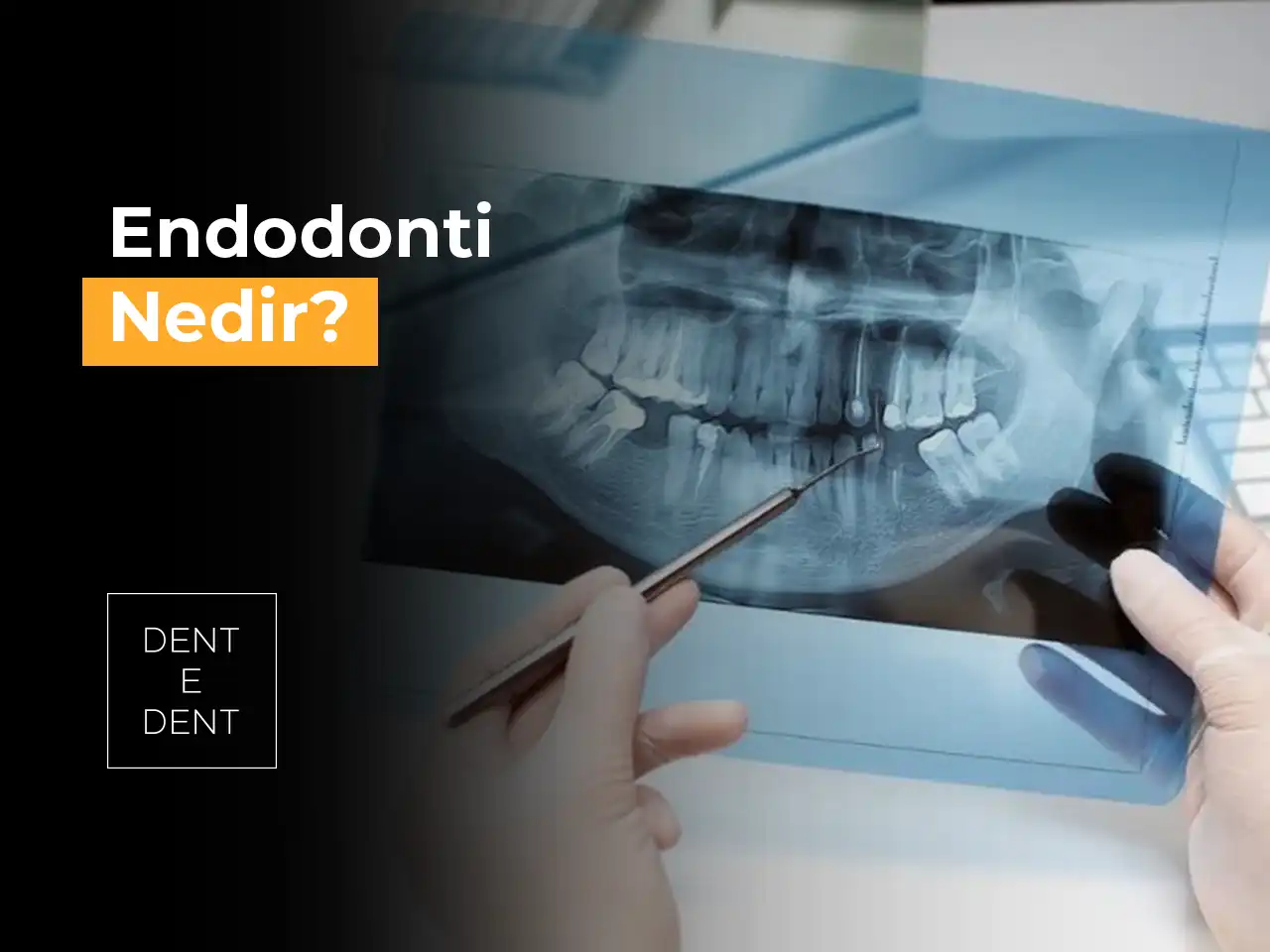 Endodonti Nedir