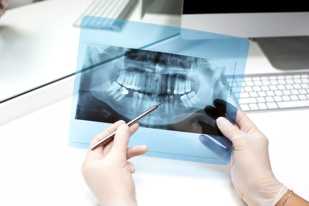 Endodonti Nedir