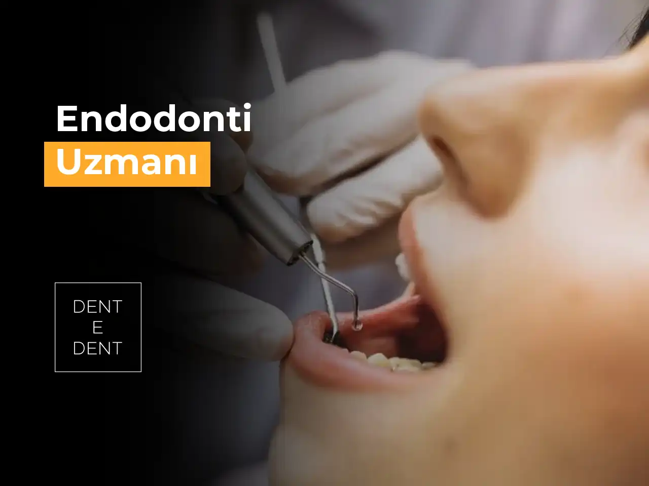 Endodonti Uzmanı