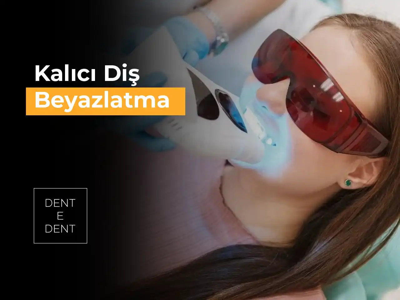 Kalıcı Diş Beyazlatma