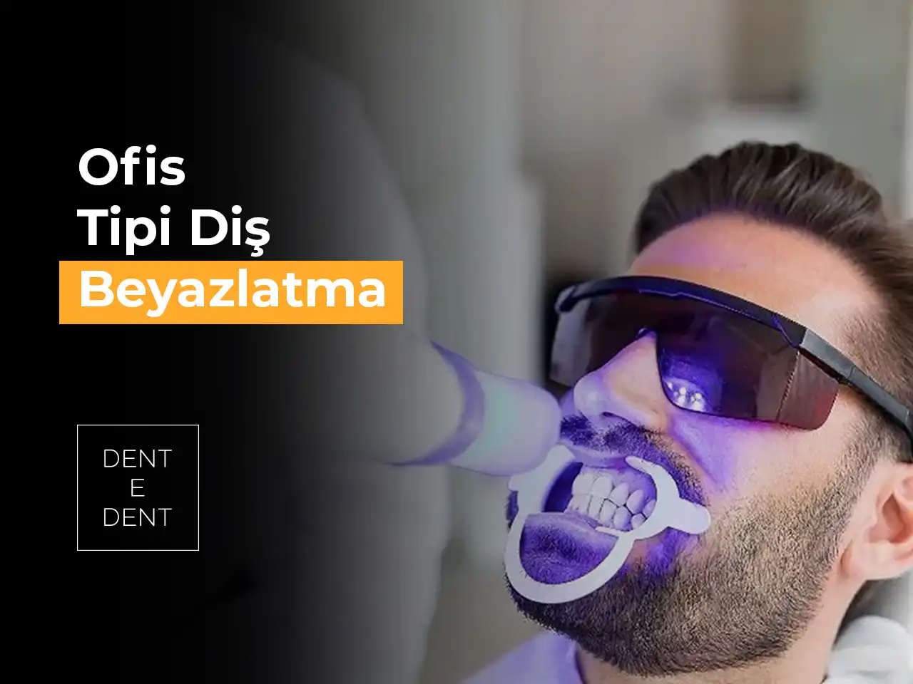 Ofis Tipi Diş Beyazlatma