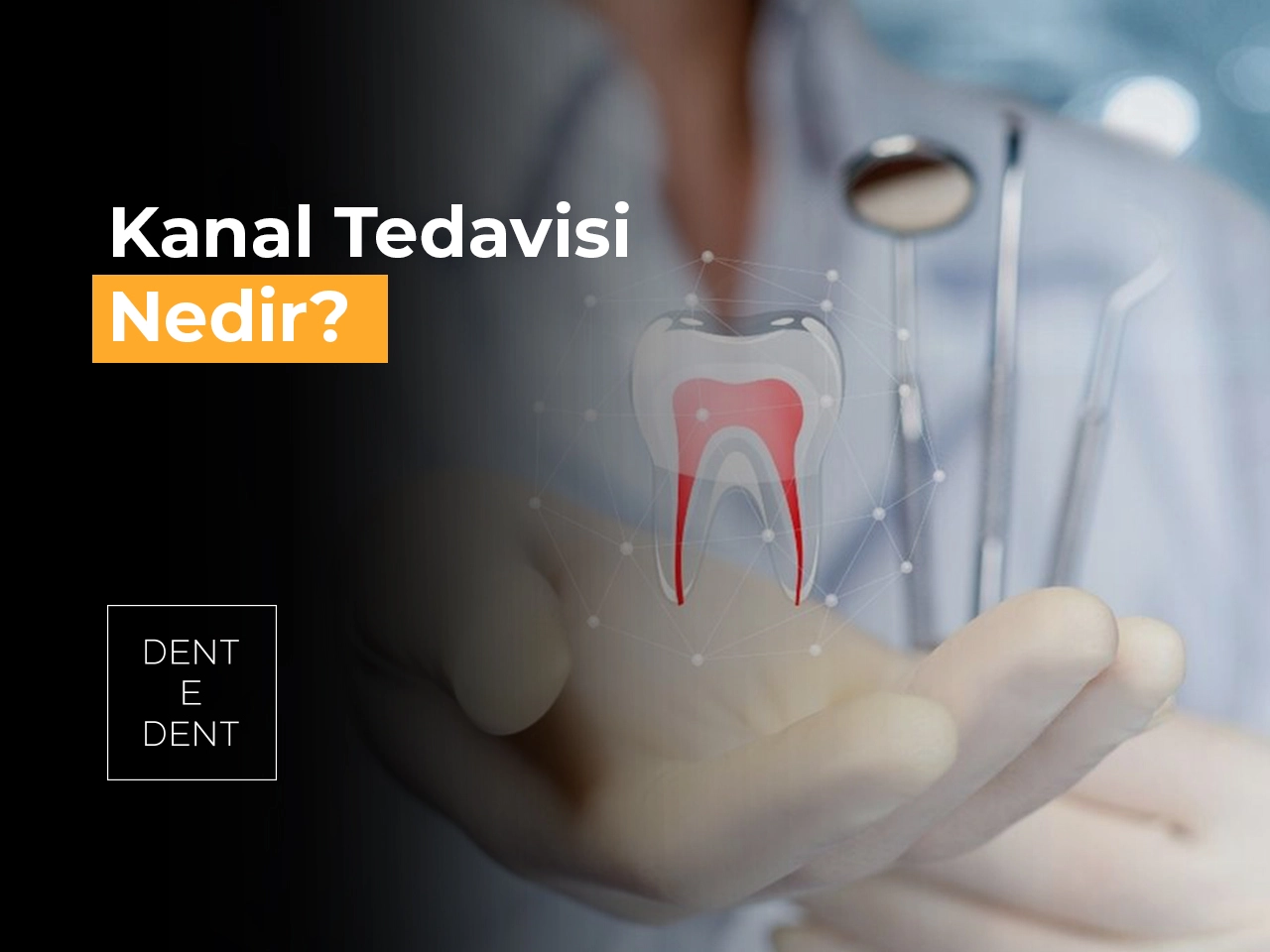 Kanal Tedavisi Nedir?