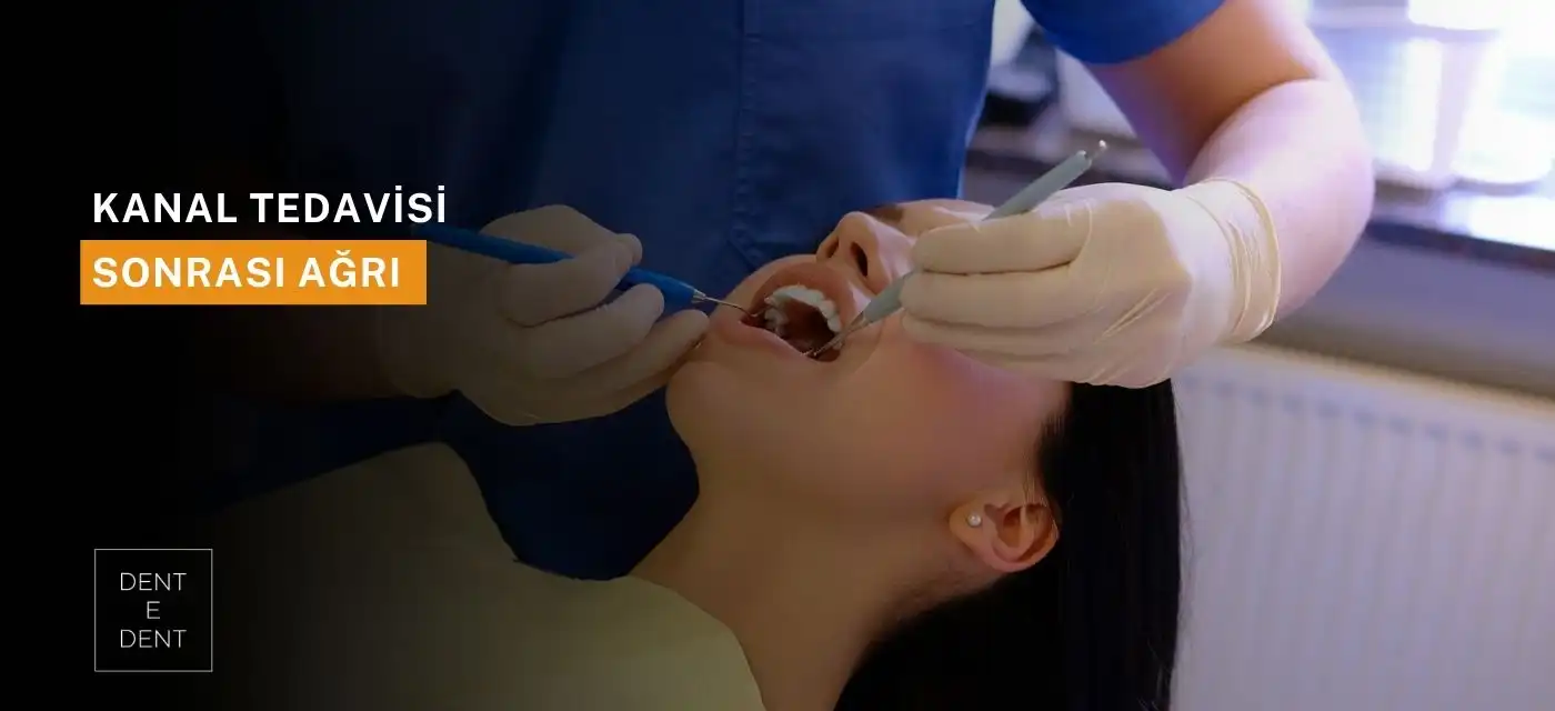 Kanal Tedavisi Sonrası Ağrı