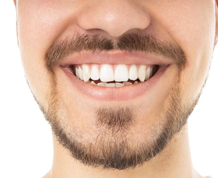 1 Günde Diş Beyazlatma Evde