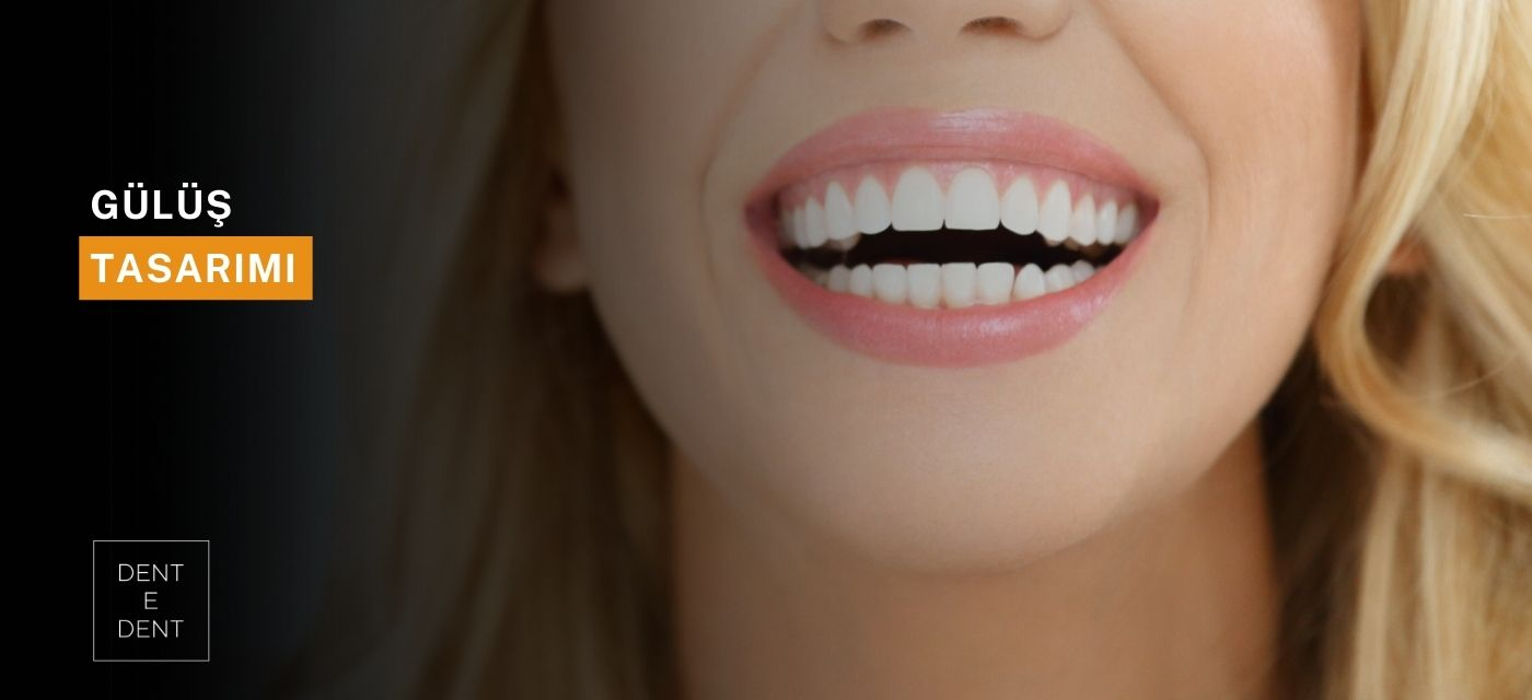 Ankara Gülüş Tasarımı