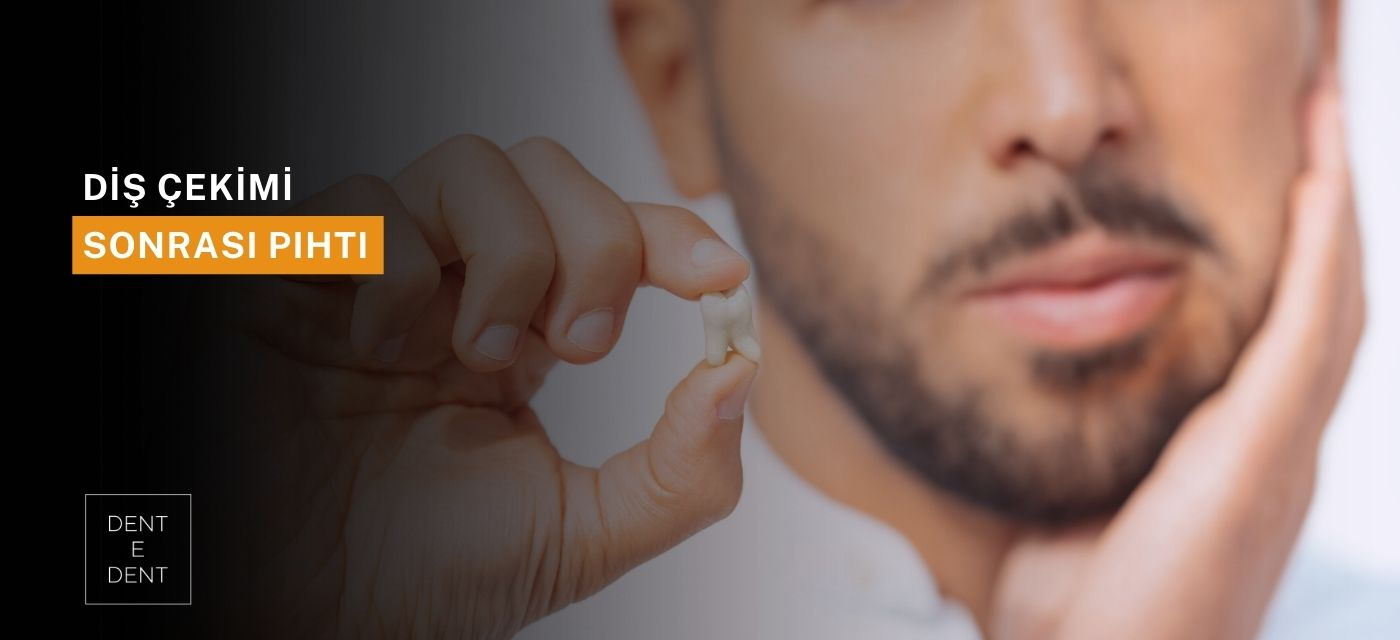 Diş Çekiminden Sonra Pıhtı Ne Zaman Düşer?