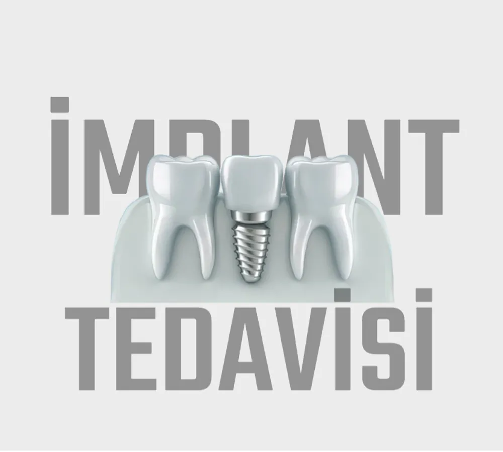 DENT E DENT IMPLANT TEDAVİSİ