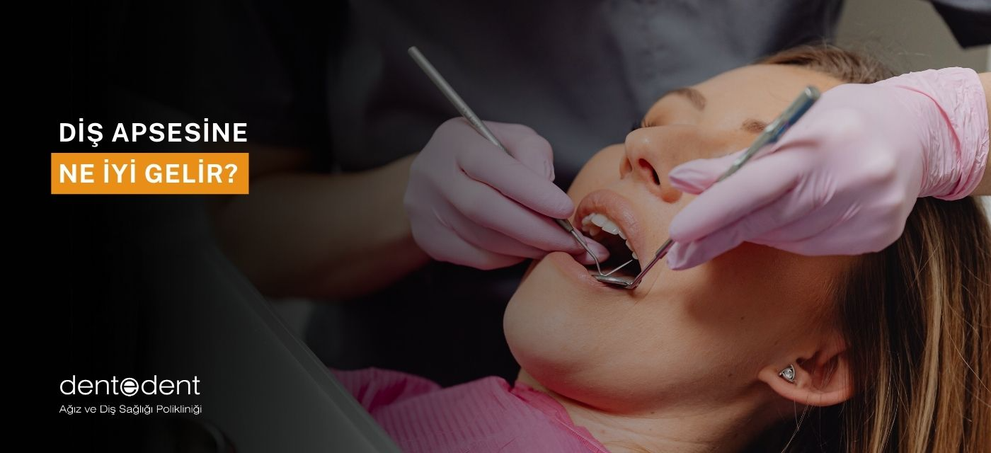 Diş Apsesine Ne İyi Gelir?