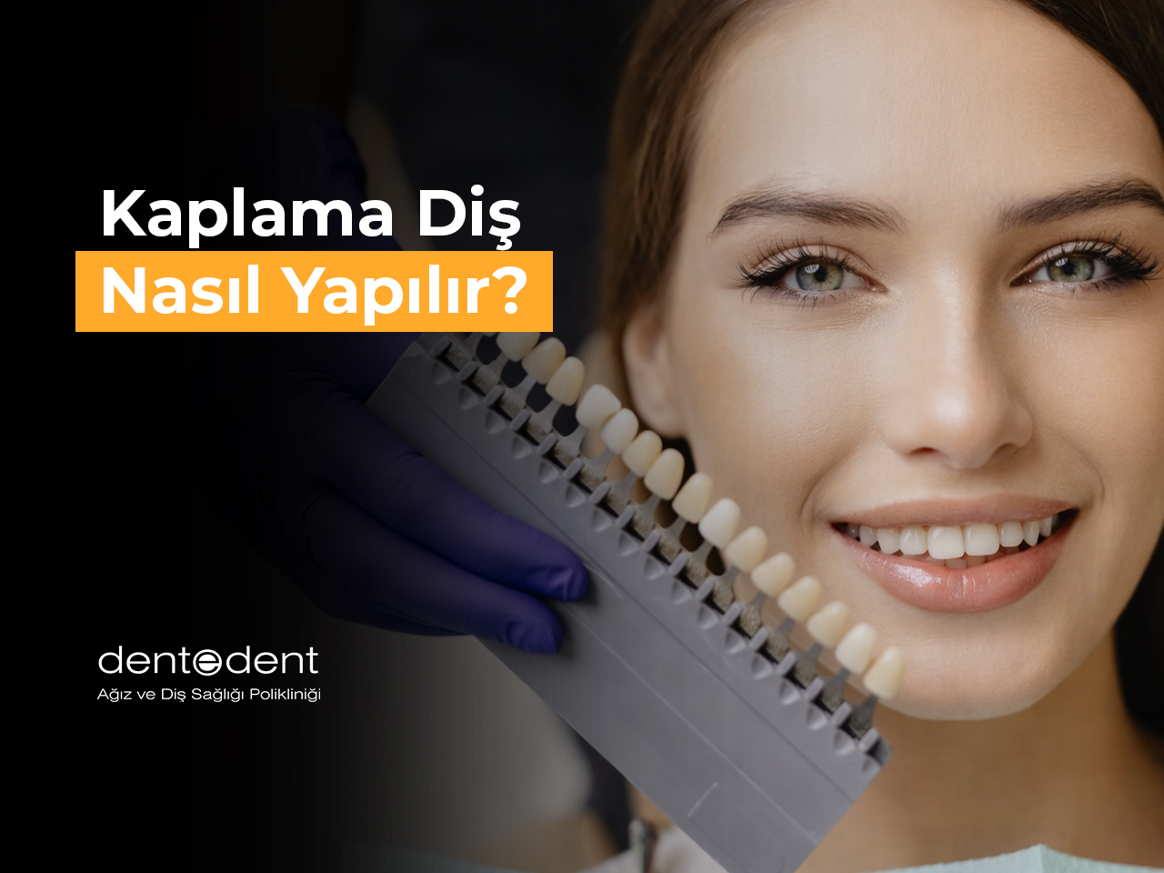 Kaplama Diş Nasıl Yapılır?