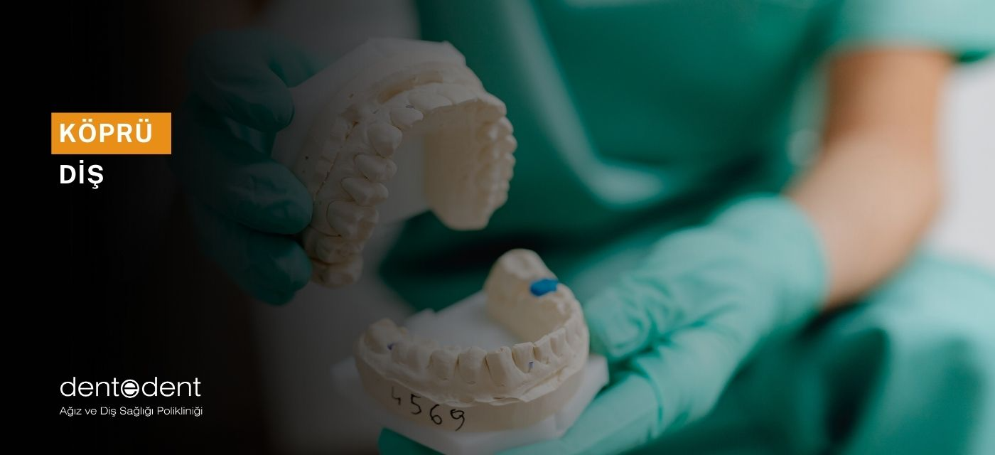Köprü Diş