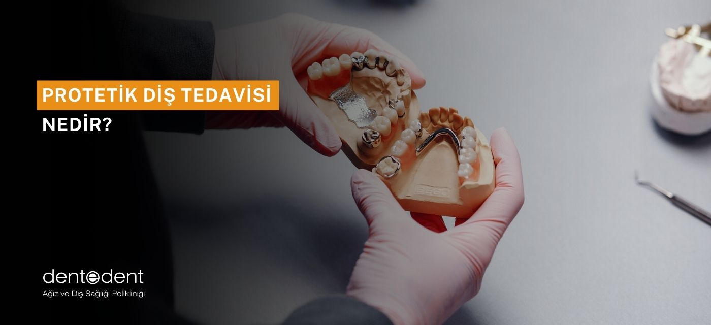 Protetik Diş Tedavisi Nedir?