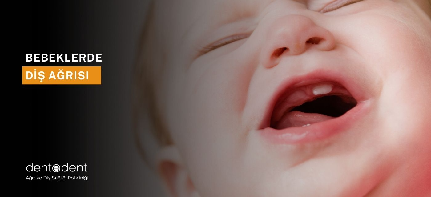 Bebeklerde Diş Ağrısına Ne İyi Gelir?