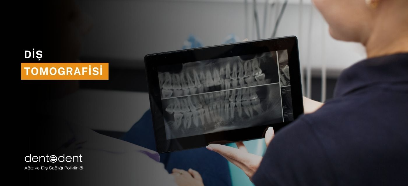 Diş Tomografisi