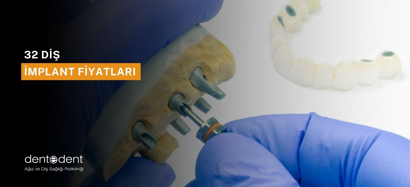 32 Diş İmplant Fiyatları